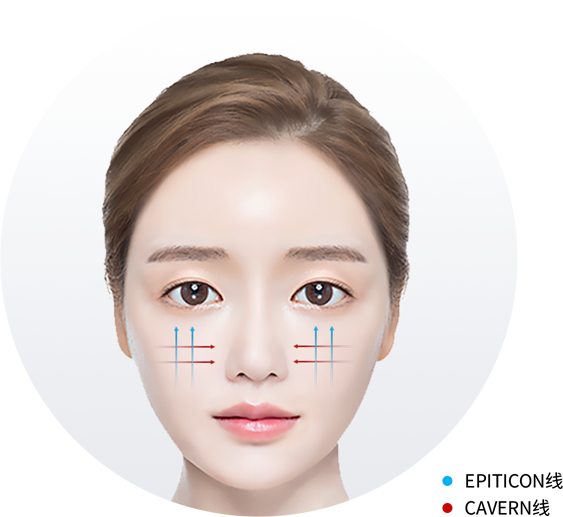 ユエンミクリニック, ユエンミ医院, 韓国美容, 韓国皮膚科, 韓国美容皮膚科値段, 渡韓整形, 美容, 江南皮膚科, 韓国, 手術, 施術, 非手術, ビフォアフター, 糸リフト, 糸リフト持続期間, インモード, シュリンク, リジュラン, フィラー, ヒアルロン酸, レナフィル, ジュビダム, ウルセラ, 矯正, 童顔, 輪郭成形, 輪郭手術,カーバン, カーバンリフト, ジャンバー, ジャンバーリフト, ミントリフト, ワンダーリフト, シルエットソフト, 目の形矯正リフト, 目尻リフト, ほうれい線リフト, ほうれい線フィーラー, 目の下のシワリフト, 目の下のくぼみリフト, 顎ラインリフト, ミント糸, エピティコン, 挙上リフト, 額挙上, 弾力, ツリ目, 目尻, 矯正, 眉, 眉間, 小じわ, 目尻のしわ, アンチエイジング, 小じわ, 中顔面, 中顔面長さ平均, 中顔面長さ理想, 中顔面短い, 中顔面短くする, 小顔, たるみ改善, フェイスライン, 卵型, Vライン, 中顔面縮小リフト, 額挙上リフト, 二重カップル手術, 眼瞼下垂, 眼瞼下垂手術, 美顔型ケア, 額挙上ダウンタイム, 額挙上読み方