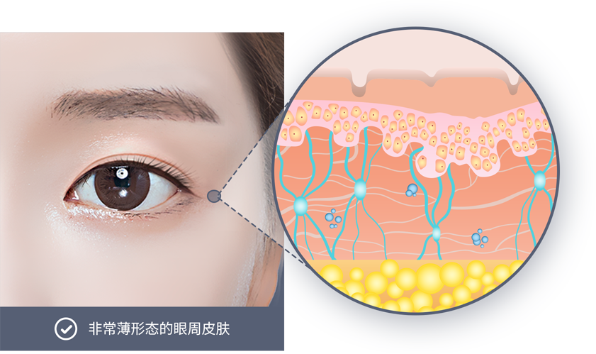 유앤미의원,유앤미클리닉,유앤미,강남유앤미,신논현유앤미,논현유앤미,서울유앤미클리닉,서울피부과,서울클리닉,한국피부과,눈꼬리리프팅,눈매교정잘하는곳,강남눈매교정,강남쌍커플수술,쌍커플수술잘하는곳,안검하수교정,눈밑지방재배치,눈매교정가격,강남얼굴리프팅,강남실리프팅잘하는곳,실리프팅