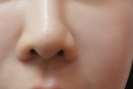 ExoSmart干细胞项目